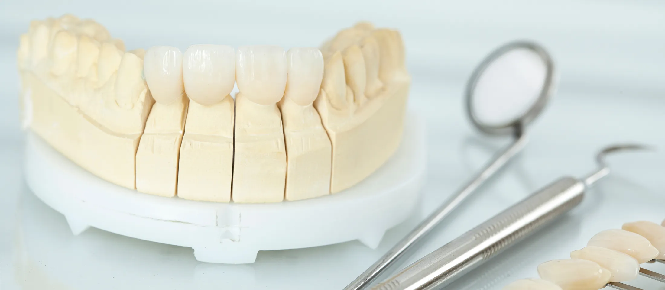 セラミック治療とは