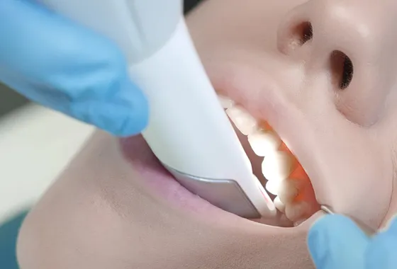 3Dスキャナーで口の中を撮影するだけですぐに歯型を取れる