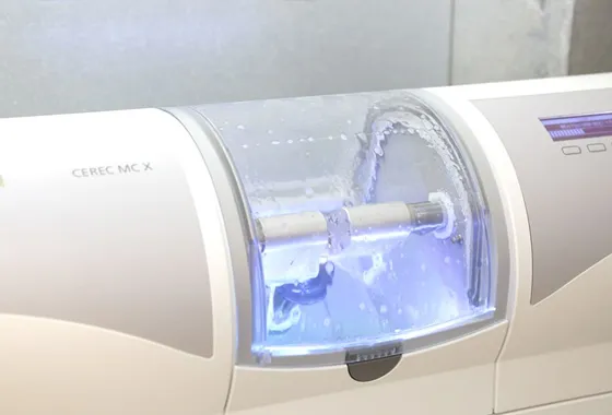 通常は工場に依頼するセラミック加工が専用マシンですぐに完成