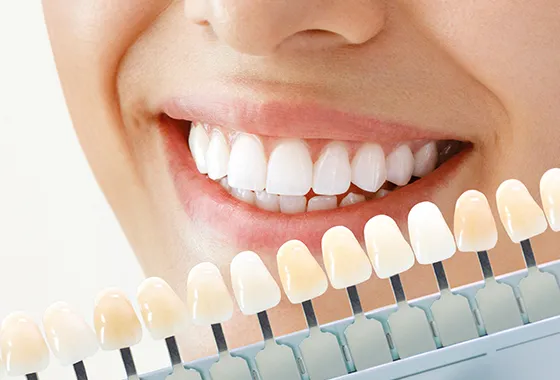 変色した歯を白くする