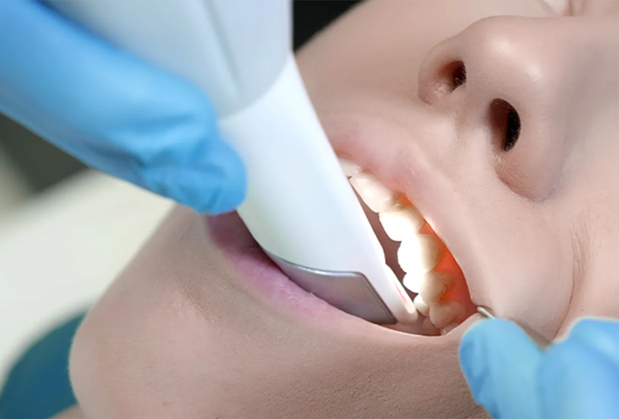 3Dスキャナー撮影で型取り不要 3Dデジタルシステムと3Dスキャナーで歯の模型データを作製