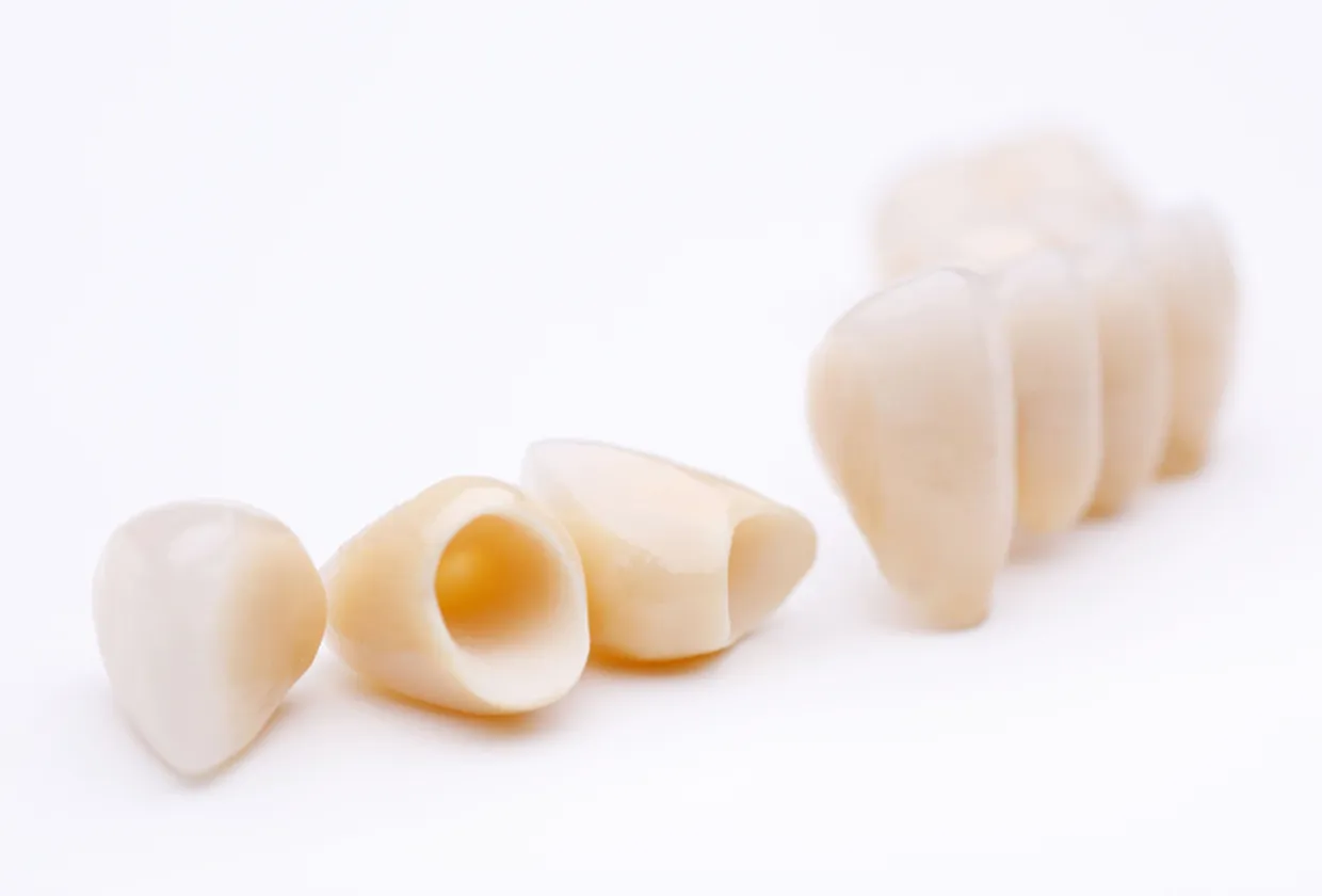 セラミック治療