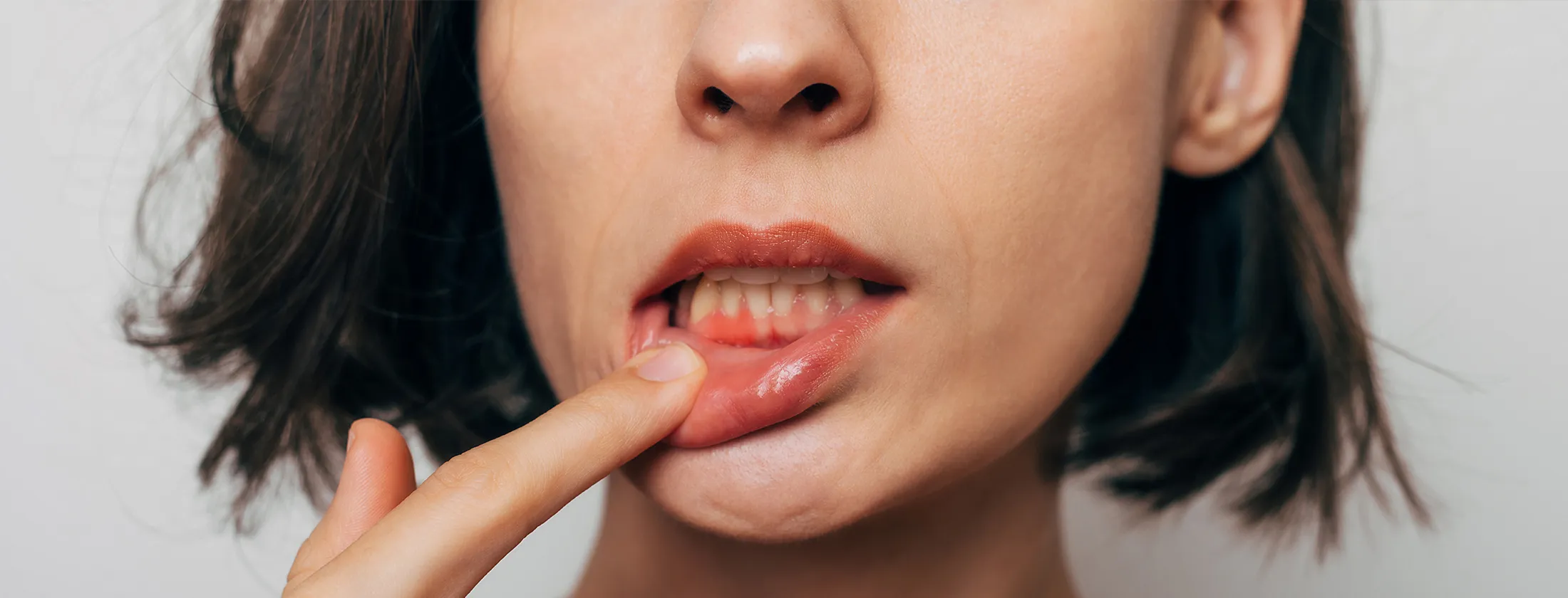 インプラントとは