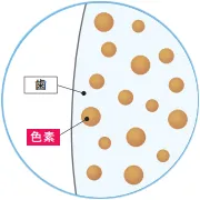 変色・着色した歯