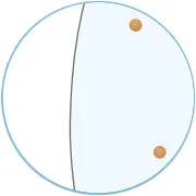 施術後の白い歯