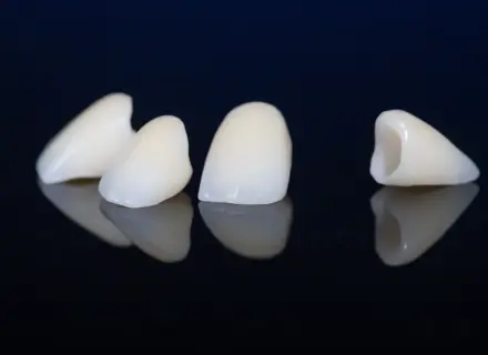 美しさと強さを兼ね備えた歯科素材〜ジルコニア治療の魅力と注意点〜