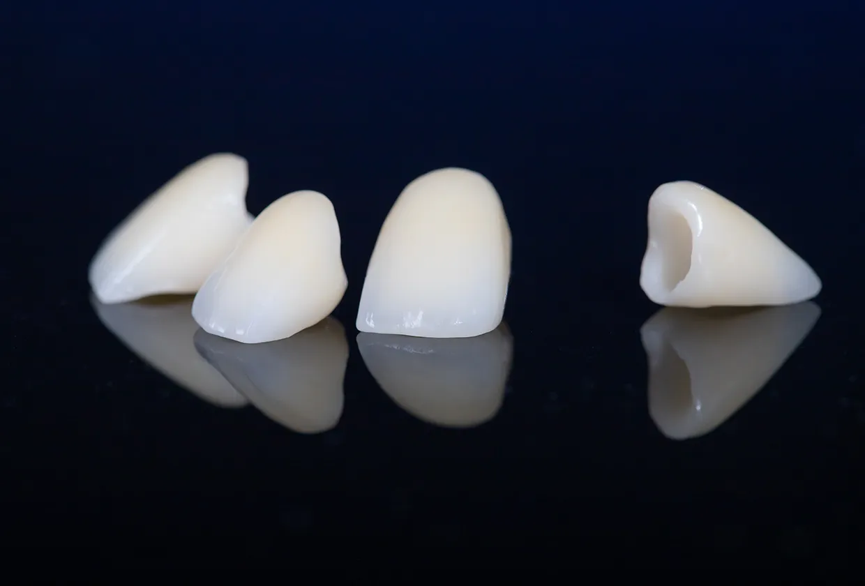 セラミック治療