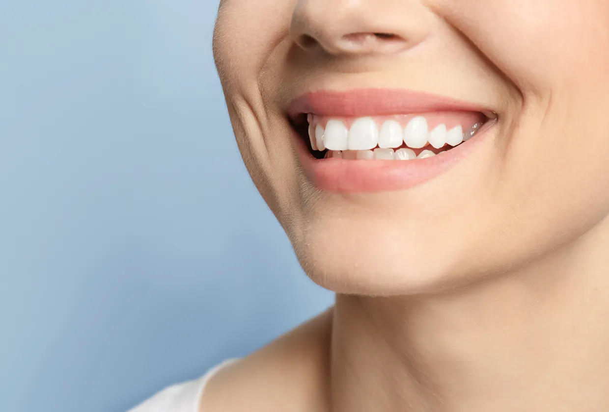 ホワイトニング